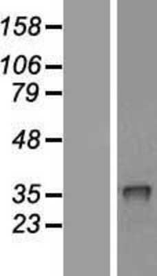 Western Blot: CRHBP Overexpression Lysate (Adult Normal) [NBL1-09476] Left-Empty vector transfected control cell lysate (HEK293 cell lysate); Right -Over-expression Lysate for CRHBP.