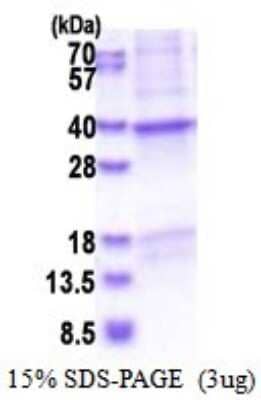 SDS-Page: CRHBP Recombinant Protein [NBP2-51572] - 15% SDS Page (3 ug)