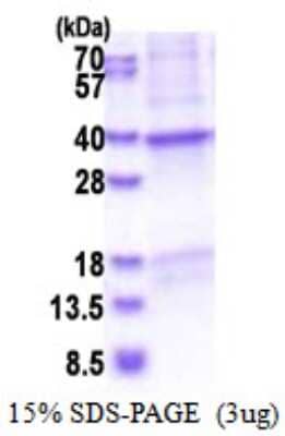 SDS-Page: CRHBP Recombinant Protein [NBP2-51572] - 15% SDS Page (3 ug)