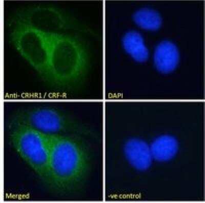 Immunocytochemistry/Immunofluorescence: CRHR1/CRF1 Antibody [NB100-57078] - Analysis of paraformaldehyde fixed MCF7 cells, permeabilized with 0.15% Triton. Primary incubation 1hr (10 ug/mL) followed by Alexa Fluor 488 secondary antibody (2 ug/mL), showing cytoplasmic and endosome staining. The nuclear stain is DAPI (blue). Negative control: Unimmunized goat IgG (10 ug/mL) followed by Alexa Fluor 488 secondary antibody (2 ug/mL).