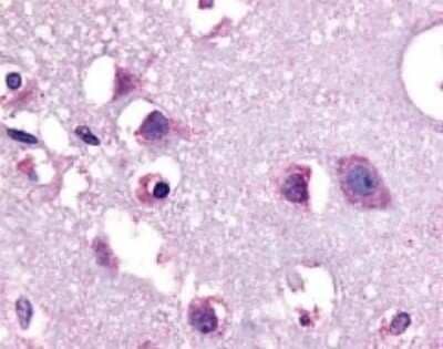 Immunohistochemistry-Paraffin: CRHR1/CRF1 Antibody [NLS1778] - Analysis of anti-CRF1 antibody with human brain, neurons and glia at 13 ug/ml.