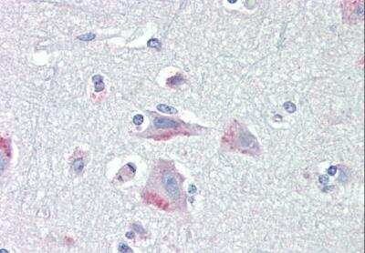 Immunohistochemistry-Paraffin: CRHR1/CRF1 Antibody [NB100-57078] - Human Cortex. Antibody at 5 ug/mL. Steamed antigen retrieval with citrate buffer pH 6, AP-staining.