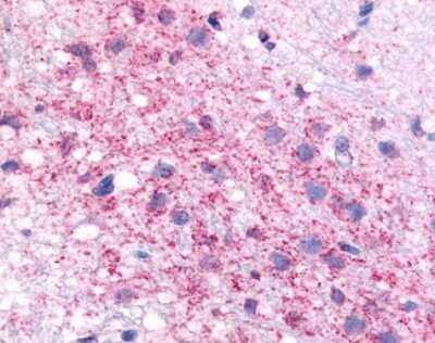 Immunohistochemistry-Paraffin: CRHR1/CRF1 Antibody [NLS1778] - Analysis of anti-CRF1 antibody with rat hypothalamus.