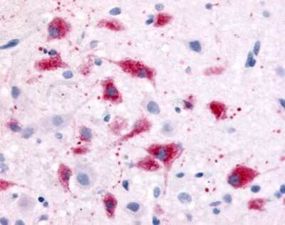 Immunohistochemistry-Paraffin: CRHR1/CRF1 Antibody [NLS1779] - Analysis of anti-CRF1 antibody with rat hypothalalmus at 21 ug/ml.