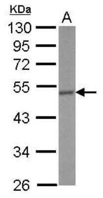 Western Blot: CRHR1/CRF1 Antibody [NBP2-16010] - Sample (50 ug of whole cell lysate)  A: Mouse brain 10% SDS PAGE diluted at 1:500  The HRP-conjugated anti-rabbit IgG antibody (NBP2-19301) was used to detect the primary antibody.