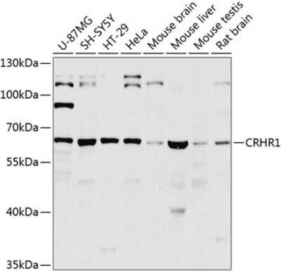 Western Blot: CRHR1/CRF1 Antibody [NBP3-05630] - Western blot analysis of extracts of various cell lines, using CRHR1/CRF1 antibody (NBP3-05630) at 1:1000 dilution. Secondary antibody: HRP Goat Anti-Rabbit IgG (H+L) at 1:10000 dilution. Lysates/proteins: 25ug per lane. Blocking buffer: 3% nonfat dry milk in TBST. Detection: ECL Basic Kit. Exposure time: 20s.