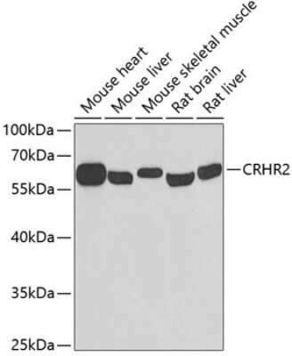 Western Blot: CRHR2/CRF2 Antibody [NBP3-03059] - Analysis of extracts of various cell lines, using CRHR2/CRF2 antibody at 1:500 dilution. Secondary antibody: HRP Goat Anti-Rabbit IgG (H+L) at 1:10000 dilution. Lysates/proteins: 25ug per lane. Blocking buffer: 3% nonfat dry milk in TBST. Detection: ECL Basic Kit