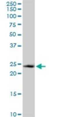 Western Blot: CRIF1 Antibody [H00090480-B01P] - Analysis of GADD45GIP1 expression in A-431.