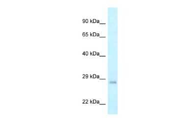 Western Blot: CRIF1 Antibody [NBP2-87211] - WB Suggested Anti-GADD45GIP1 Antibody. Titration: 1.0 ug/ml. Positive Control: Hela Whole CellGADD45GIP1 is supported by BioGPS gene expression data to be expressed in HeLa