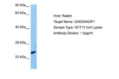 Western Blot: CRIF1 Antibody [NBP2-87212] - Host: Rabbit. Target Name: GADD45GIP1. Sample Tissue: HCT15 Whole Cell lysates. Antibody Dilution: 1.0ug/ml