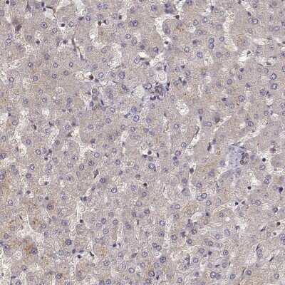 Immunohistochemistry-Paraffin CRIM1 Antibody