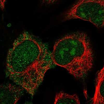 Immunocytochemistry/Immunofluorescence: CRIP2 Antibody [NBP1-84379] - Immunofluorescent staining of human cell line U-2 OS shows localization to nucleus, nucleoli & plasma membrane.