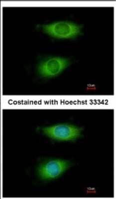 Immunocytochemistry/Immunofluorescence: CRIP2 Antibody [NBP2-16011] - Immunofluorescence analysis of methanol-fixed HeLa, using antibody at 1:200 dilution.