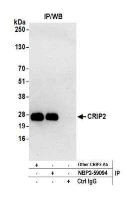 Immunoprecipitation: CRIP2 Antibody [NBP2-59094] - Detection of human CRIP2 by western blot of immunoprecipitates. Samples: Whole cell lysate (0.5 or 1.0 mg per IP reaction; 20% of IP loaded) from HeLa cells prepared using NETN lysis buffer. Antibodies: Affinity purified rabbit anti-CRIP2 antibodyNBP2-59094 used for IP at 20 ul per reaction. CRIP2 was also immunoprecipitated by another rabbit anti-CRIP2 antibody. For blotting immunoprecipitated CRIP2, NBP2-59094 was used at 1:250. Detection: Chemiluminescence with an exposure time of 30 seconds.
