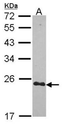 Western Blot: CRIP2 Antibody [NBP2-16011] - Sample (30 ug of whole cell lysate) A: Hela 12% SDS PAGE gel, diluted at 1:1000.