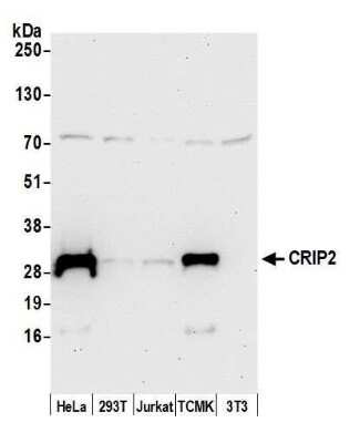 Western Blot: CRIP2 Antibody [NBP2-59094] - Detection of human and mouse CRIP2 by western blot. Samples: Whole cell lysate (50 ug) from HeLa, 293T, Jurkat, mouse TCMK-1, and mouse NIH3T3 cells prepared using NETN lysis buffer. Antibody: Affinity purified rabbit anti-CRIP2 antibody NBP2-59094 used for WB at 1:1000. Detection: Chemiluminescence with an exposure time of 30 seconds.