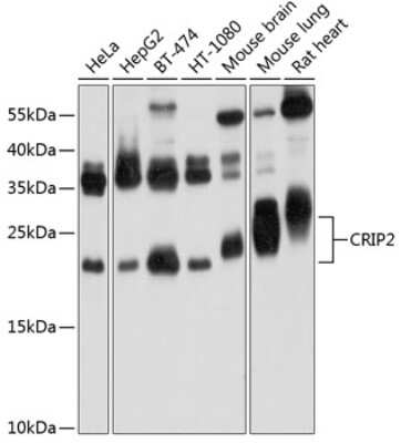 Western Blot: CRIP2 Antibody [NBP2-92574] - Analysis of extracts of various cell lines, using CRIP2 at 1:1000 dilution.Secondary antibody: HRP Goat Anti-Rabbit IgG (H+L) at 1:10000 dilution.Lysates/proteins: 25ug per lane.Blocking buffer: 3% nonfat dry milk in TBST.Detection: ECL Basic Kit .Exposure time: 30s.