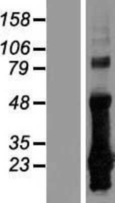 Western Blot: CRIP2 Overexpression Lysate (Adult Normal) [NBL1-09478] Left-Empty vector transfected control cell lysate (HEK293 cell lysate); Right -Over-expression Lysate for CRIP2.