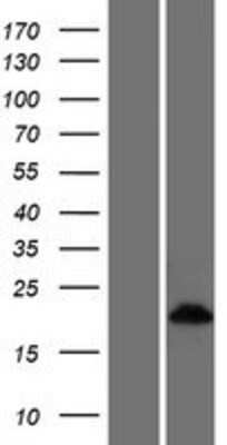 Western Blot: CRIP3 Overexpression Lysate (Adult Normal) [NBP2-04522] Left-Empty vector transfected control cell lysate (HEK293 cell lysate); Right -Over-expression Lysate for CRIP3.