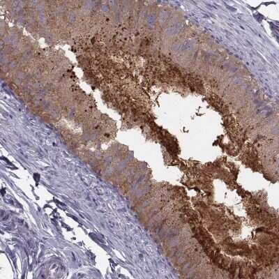 Immunohistochemistry-Paraffin: CRISP-1 Antibody [NBP1-89226] - Staining of human epididymis shows high expression.