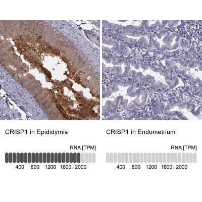 Immunohistochemistry-Paraffin: CRISP-1 Antibody [NBP1-89226] - Analysis in human epididymis and endometrium tissues. Corresponding CRISP-1 RNA-seq data are presented for the same tissues.