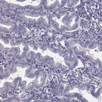 <b>Orthogonal Strategies Validation. </b>Immunohistochemistry-Paraffin: CRISP-1 Antibody [NBP1-89226] - Staining of human endometrium shows no positivity in glandular cells as expected.