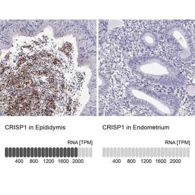 <b>Orthogonal Strategies Validation. </b>Immunohistochemistry-Paraffin: CRISP-1 Antibody [NBP2-62601] - Analysis in human epididymis and endometrium tissues. Corresponding CRISP-1 RNA-seq data are presented for the same tissues.