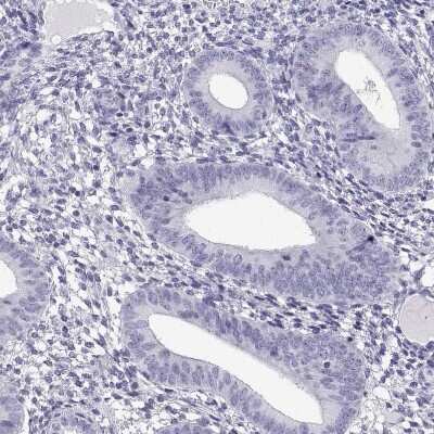 Immunohistochemistry-Paraffin: CRISP-1 Antibody [NBP2-62601] - Staining of human endometrium shows no positivity in glandular cells as expected.