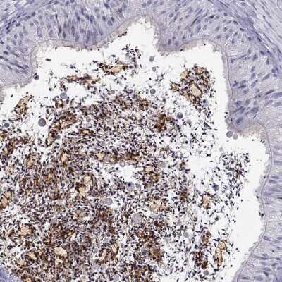 Immunohistochemistry-Paraffin: CRISP-1 Antibody [NBP2-62601] - Staining of human epididymis shows strong cytoplasmic and membranous positivity in glandular cells.