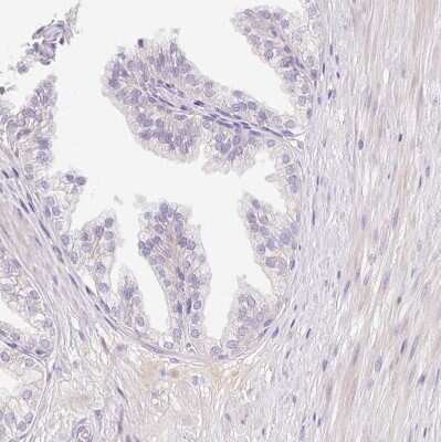 Immunohistochemistry-Paraffin: CRISP-3 Antibody [NBP2-33714] - Staining of human prostate shows no positivity in glandular cells as expected.