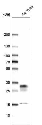 Western Blot: CRISP-3 Antibody [NBP2-33714] - Analysis in human fallopian tube tissue.