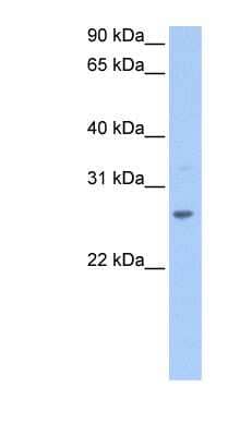 Western Blot: CRISP1 Antibody [NBP1-79533] - 721_B cell lysate, concentration 0.2-1 ug/ml.