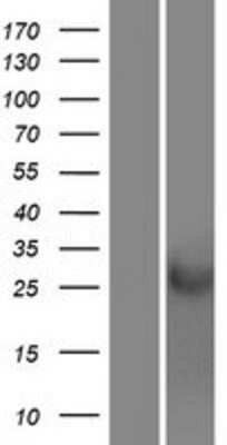 Western Blot: CRISP1 Overexpression Lysate (Adult Normal) [NBP2-08231] Left-Empty vector transfected control cell lysate (HEK293 cell lysate); Right -Over-expression Lysate for CRISP1.