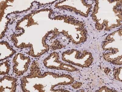 Immunohistochemistry-Paraffin: CRISPLD1 Antibody [NBP2-97241] - Staining of human CRISPLD1 in human prostate with rabbit polyclonal antibody at 1:200 dilution.