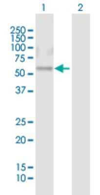 Western Blot: CRISPLD1 Antibody [H00083690-B01P] - Analysis of CRISPLD1 expression in transfected 293T cell line by CRISPLD1 polyclonal antibody.  Lane 1: CRISPLD1 transfected lysate(55 KDa). Lane 2: Non-transfected lysate.