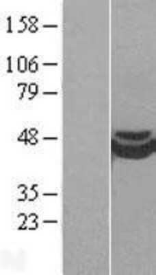 Western Blot: CRISPLD1 Overexpression Lysate (Adult Normal) [NBP2-04400] Left-Empty vector transfected control cell lysate (HEK293 cell lysate); Right -Over-expression Lysate for CRISPLD1.