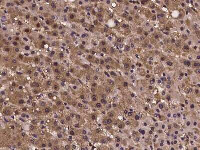 Immunohistochemistry-Paraffin: CRISPLD2 Antibody [NBP2-97242] - Immunochemical staining of human CRISPLD2 in human liver with rabbit polyclonal antibody at 1:100 dilution, formalin-fixed paraffin embedded sections.