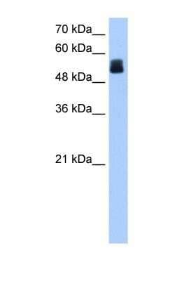 Western Blot: CRISPLD2 Antibody [NBP1-69620] - This Anti-CRISPLD2 antibody was used in Western Blot of Jurkat tissue lysate at a concentration of 1ug/ml.