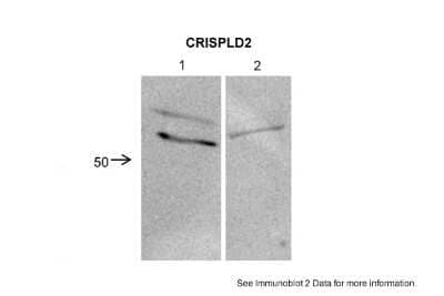 Western Blot: CRISPLD2 Antibody [NBP1-69620] - 1. Human Lung Fibroblast cells (40ug) 2. Mouse lung cells (40ug) Primary dilution: 1 : 2000 Secondary Antibody: Anti-rabbit IgG horseradish peroxidase Secondary dilution: 1 : 1000.
