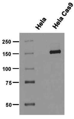 Western Blot: CRISPR-Cas9 Antibody (6G12) - C-terminus - Azide and BSA Free [NBP2-80680] - Control HeLa cells (un-transfected) and HeLa cells expressing Flag-tagged S. pyogenes's CRISPR-Cas9 under the control of PTight (Tet-ON) promoter. Samples were treated for 24 hours with 1ug/uL of Doxycyclin and lysed under native conditions. 30 ug of the whole cell lysate from each sample type per lane was separated by 7.5% SDS-PAGE. Nitrocellulose membrane was incubated with CRISPR-Cas9 antibody clone 6G12 (hybridoma supernatant diluted 1:100 at 4C O/N). After washing, the membranes were incubated with secondary HRP-coupled antibody and bands were visualized by ECL and exposure of X-ray films. Prestained marker bands were visualized with Blue Marker Antibody (NBP2-33376). The image shown is from 1 minute exposure time. Observed molecular weight is ~158 kDa. Image from the standard format of this antibody.