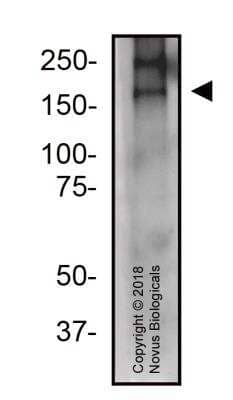 Western Blot: CRISPR-Cas9 Antibody [NBP2-66379] - Total protein from Cas9 transfected Hek293T cells was separated on a 7.5% gel by SDS-PAGE, transferred to PVDF membrane and blocked in 5% non-fat milk in TBST. The membrane was probed with 2.0 ug/ml anti-Cas9 in block buffer and detected with an anti-rabbit HRP secondary antibody using chemiluminescence. Expected molecular weight: 158.4 kDa.