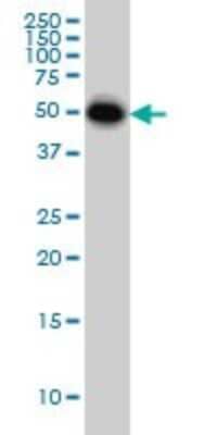 Western Blot: CRLF1 Antibody (4F4) [H00009244-M01] - CRLF1 monoclonal antibody (M01), clone 4F4 Analysis of CRLF1 expression in HeLa.