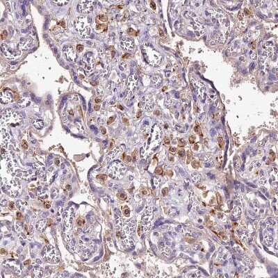 Immunohistochemistry-Paraffin: CRLF1 Antibody [NBP1-85606] - Staining of human placenta shows moderate cytoplasmic positivity in Hofbauer cells.