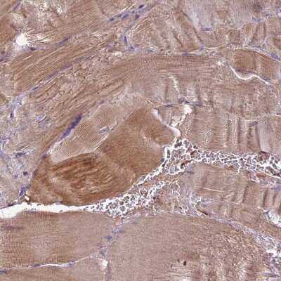 Immunohistochemistry-Paraffin: CRLF1 Antibody [NBP1-85606] - Staining of human skeletal muscle shows moderate cytoplasmic positivity in myocytes.