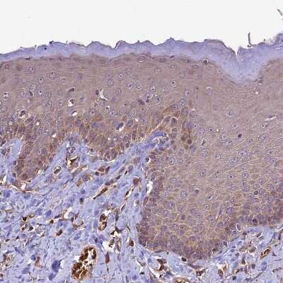 Immunohistochemistry-Paraffin: CRLF1 Antibody [NBP1-85606] - Staining of human skin shows weak cytoplasmic positivity in squamous epithelial cells.