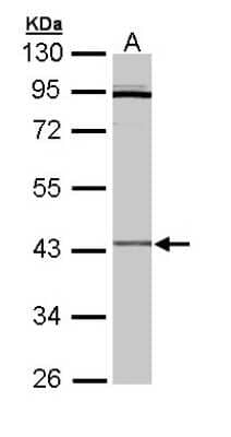 Western Blot: CRLF1 Antibody [NBP1-32792] - Sample (30 ug of whole cell lysate)A: Hep G2  10% SDS PAGE, antibody diluted at 1:3000.