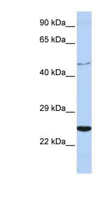 Western Blot: CRLF1 Antibody [NBP1-58328] - Jurkat cell lysate, concentration 0.2-1 ug/ml.