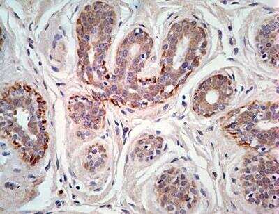 Immunohistochemistry-Paraffin: CRLF2 Antibody [NBP2-29613] - IHC-P analysis of CRLF2 protein in a section of normal breast tissue using CRLF2 antibody at a concentration of 5 ug/ml. The breast ductal or acinar epithelial cells showed moderate expression whereas the myoepithelial cells depicted very strong CRLF2 positivity. The interlobular stroma/connective tissue showed weak to negligible staining. 