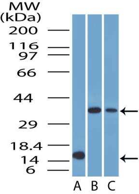 Western Blot: CRLF2 Antibody [NBP2-29613] - Western blot analysis of CRLF2 antibody in 1. partial recombinant CRLF2 protein 2. Human skeletal muscle lysate and 3. Human liver lysate 