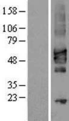 Western Blot TSLPR/CRLF2 Overexpression Lysate